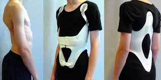 kyphologic brace